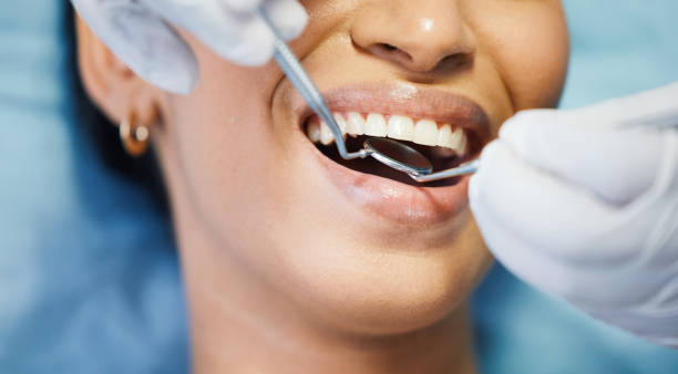 Best Emergency Wisdom Tooth Extraction in Lawrence, NY
